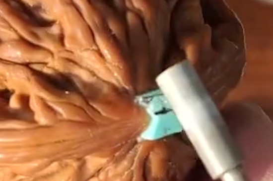 核桃鑲嵌松石教程